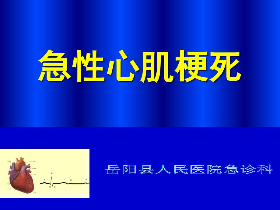 《急性心肌梗死》优质课件_第1页