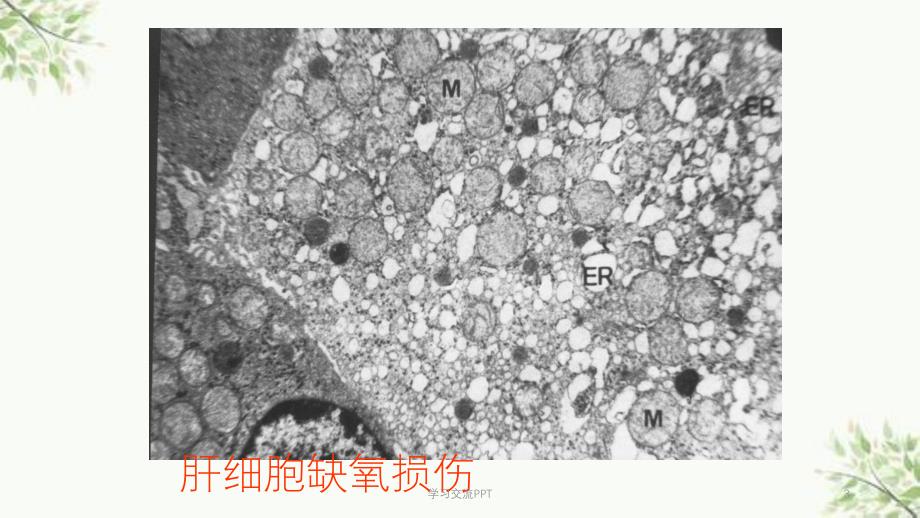 病理学实习指导电镜图片课件_第3页