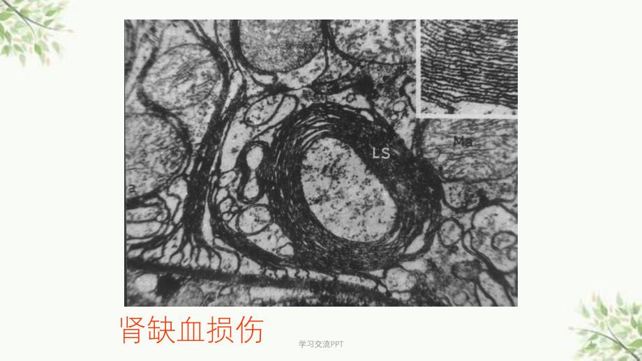 病理学实习指导电镜图片课件_第4页