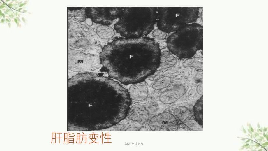 病理学实习指导电镜图片课件_第5页