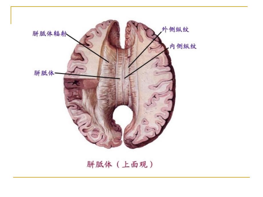 胼胝体病变_第3页