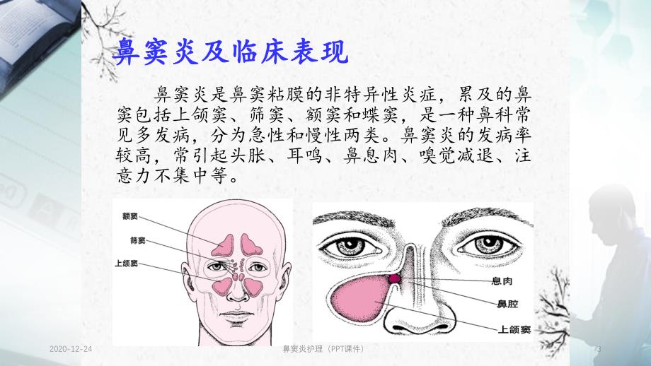 鼻窦炎护理PPT课件_第3页