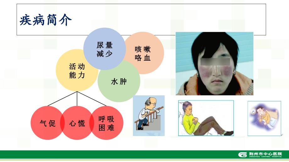 风湿性心脏病的健康教育_第3页