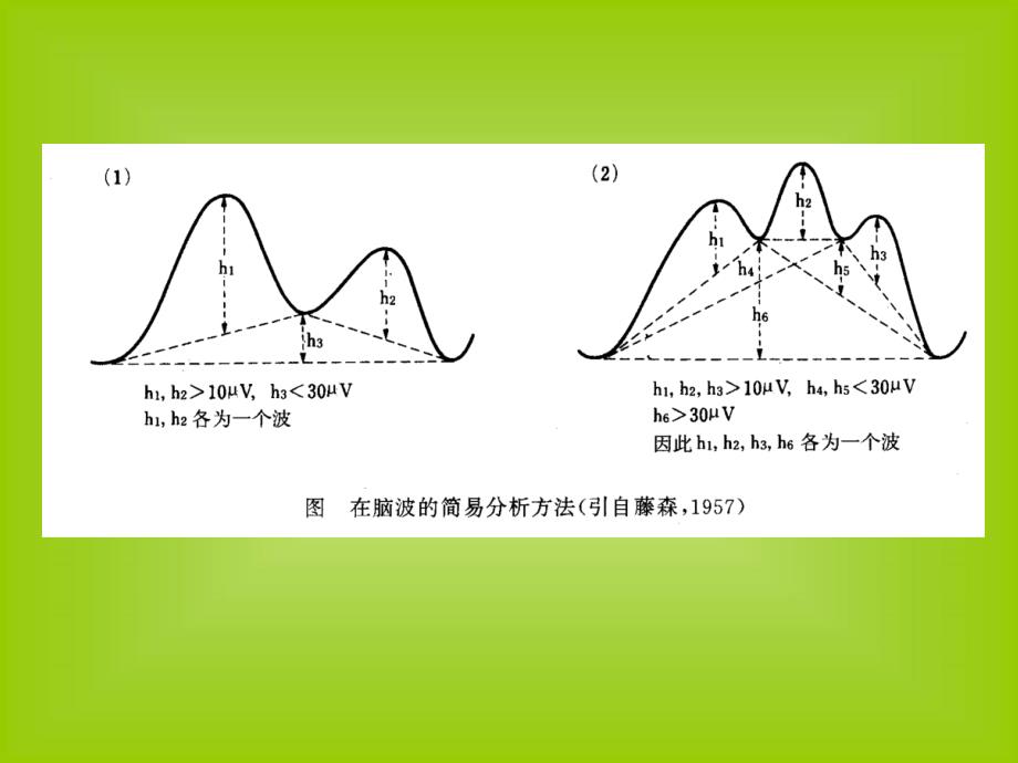 脑电图基本知识_第3页