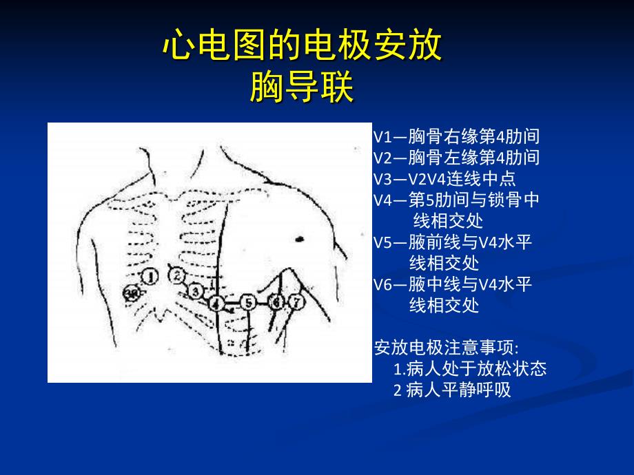 心电图三基培训_第2页