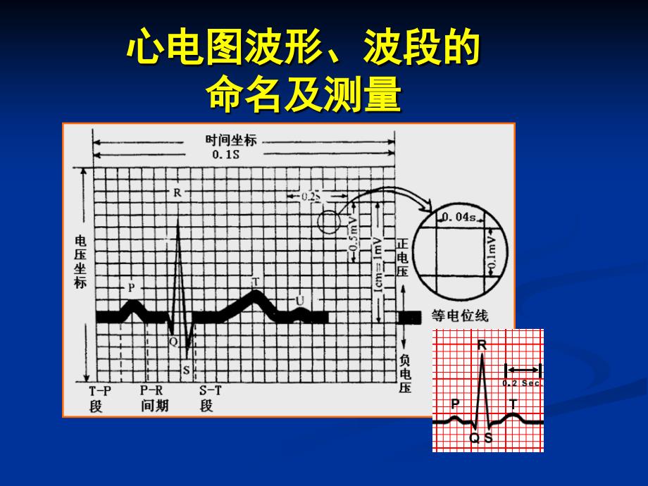 心电图三基培训_第3页