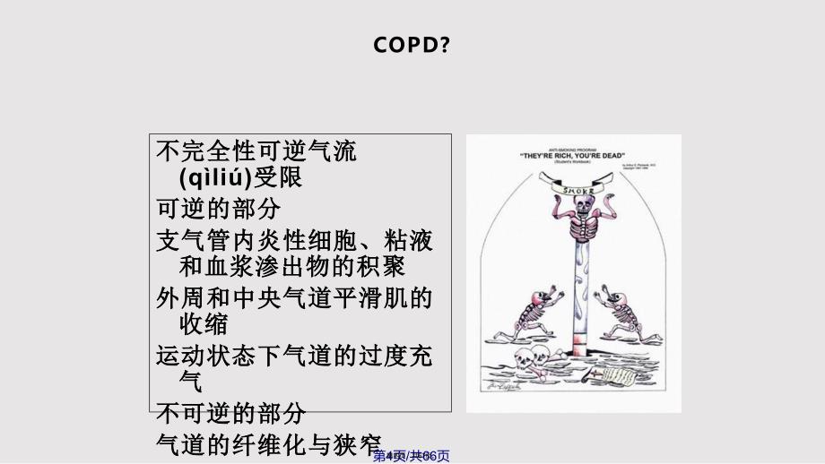 COPD病人围术期处理实用教案_第4页