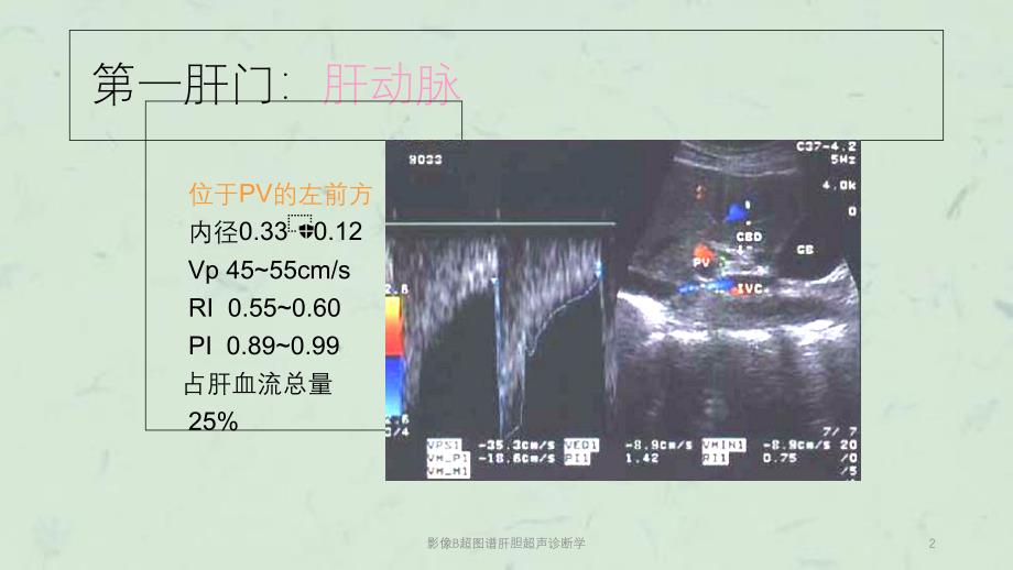 影像B超图谱肝胆超声诊断学课件_第2页