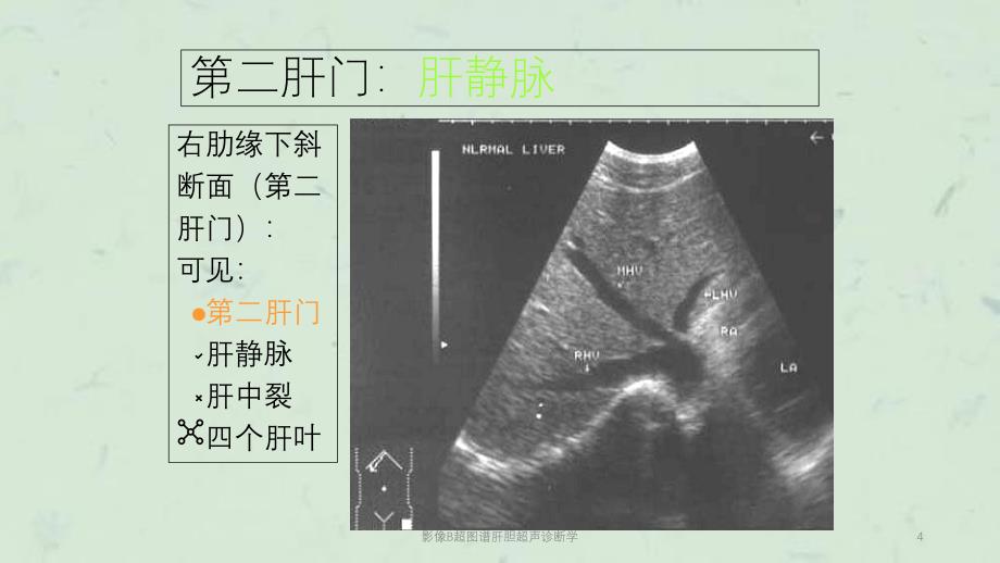 影像B超图谱肝胆超声诊断学课件_第4页