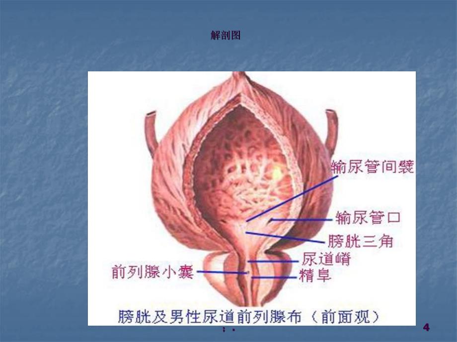 膀胱癌护理查房ppt课件_第4页