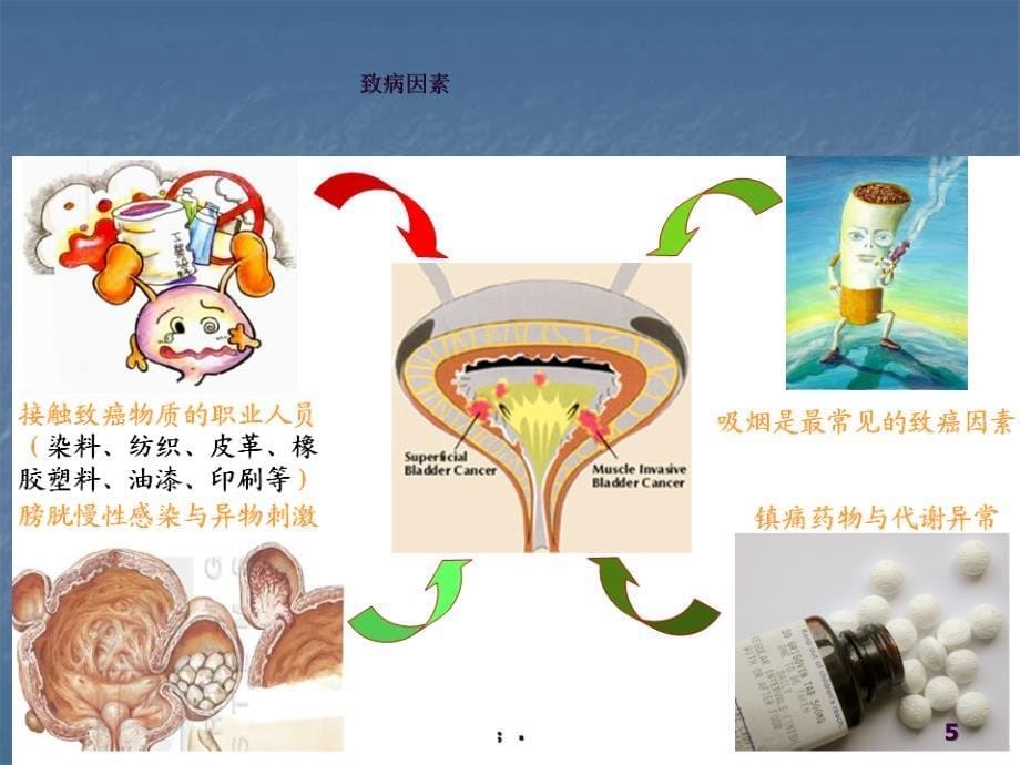 膀胱癌护理查房ppt课件_第5页