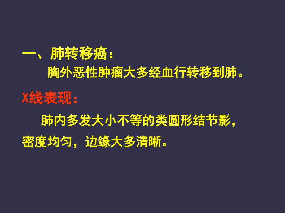 肺癌的影像诊断2_第2页