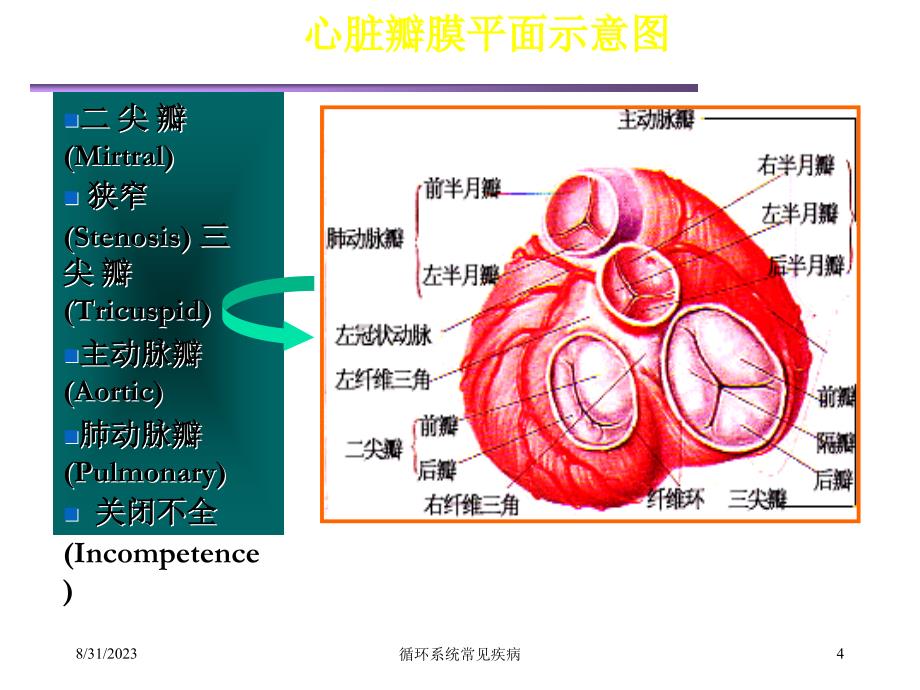 循环系统常见疾病_第4页