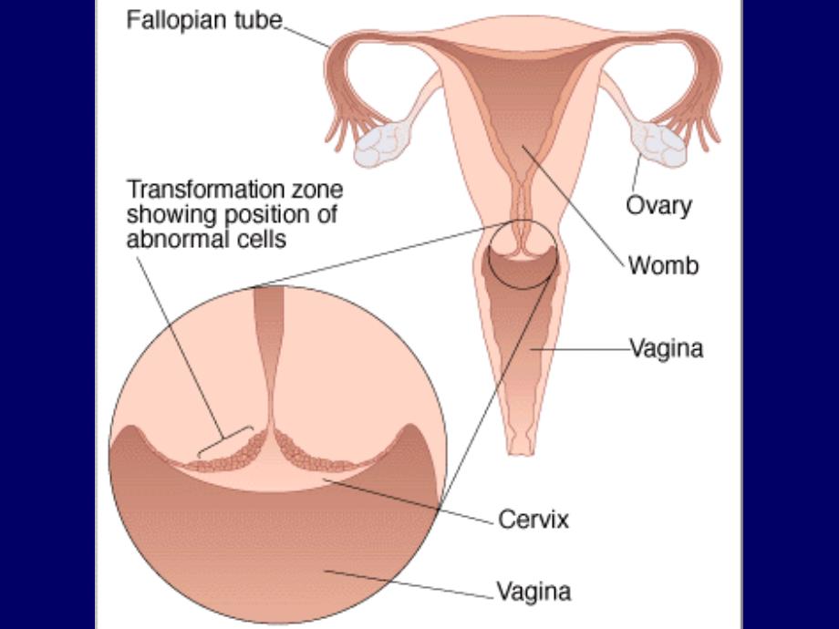 病理学-女性生殖系统及乳腺疾病_第2页