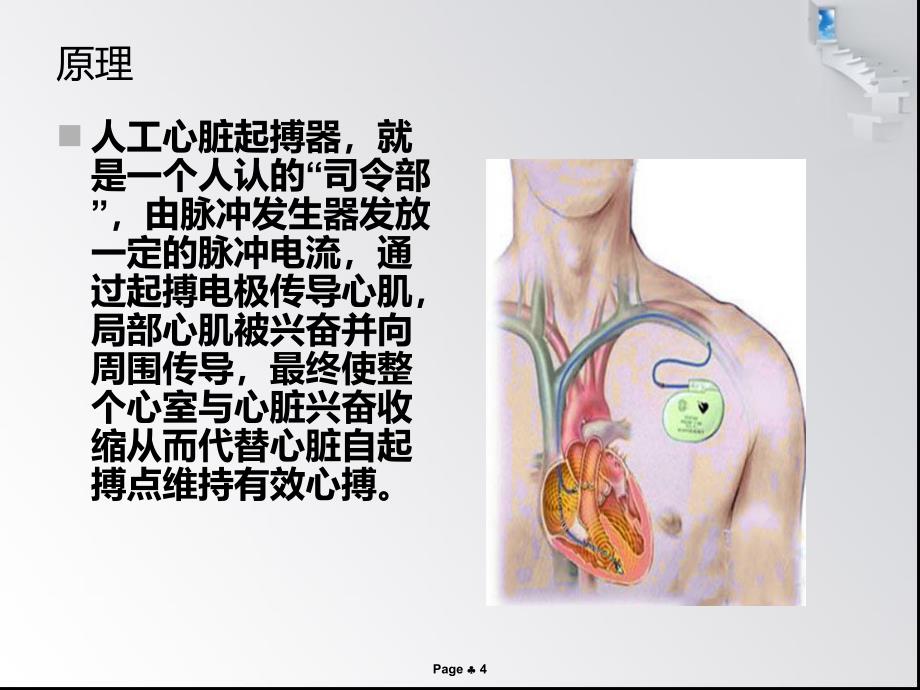 永久性心脏起搏器植入术后护理课件_第4页