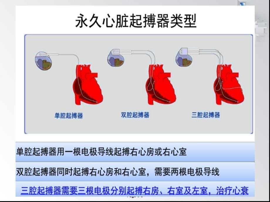 永久性心脏起搏器植入术后护理课件_第5页