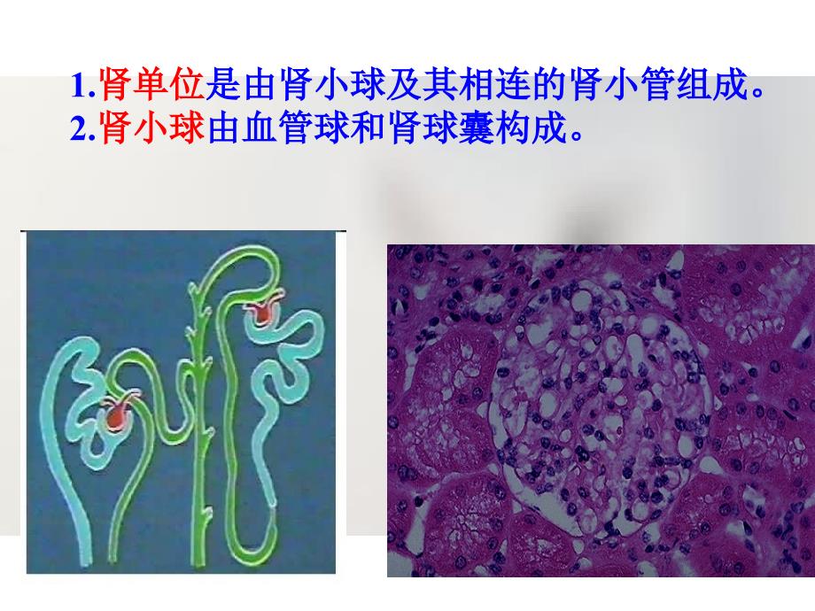 病理学第八泌尿系统疾病_第3页