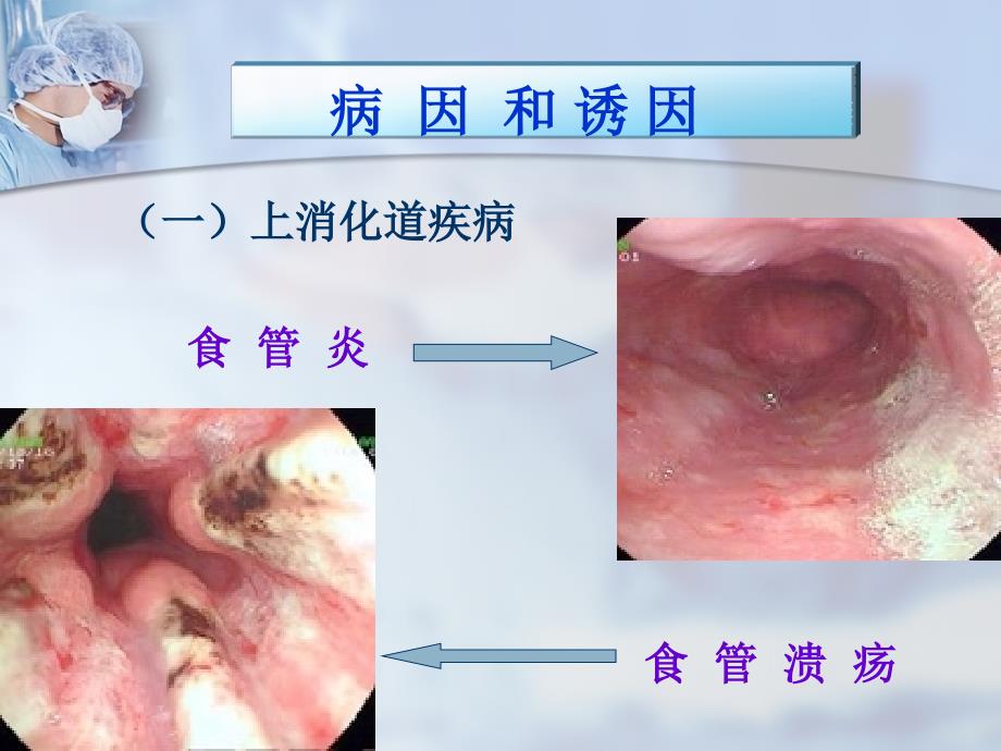 最新(内科护理学)第十二节上消化道大出血精选PPT文档_第4页