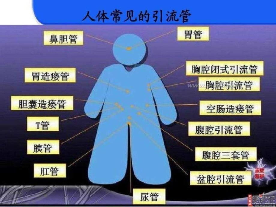 各种引流管的护理图文.ppt1_第4页