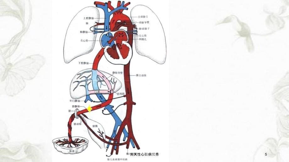 先天性心脏病优秀课件_第5页