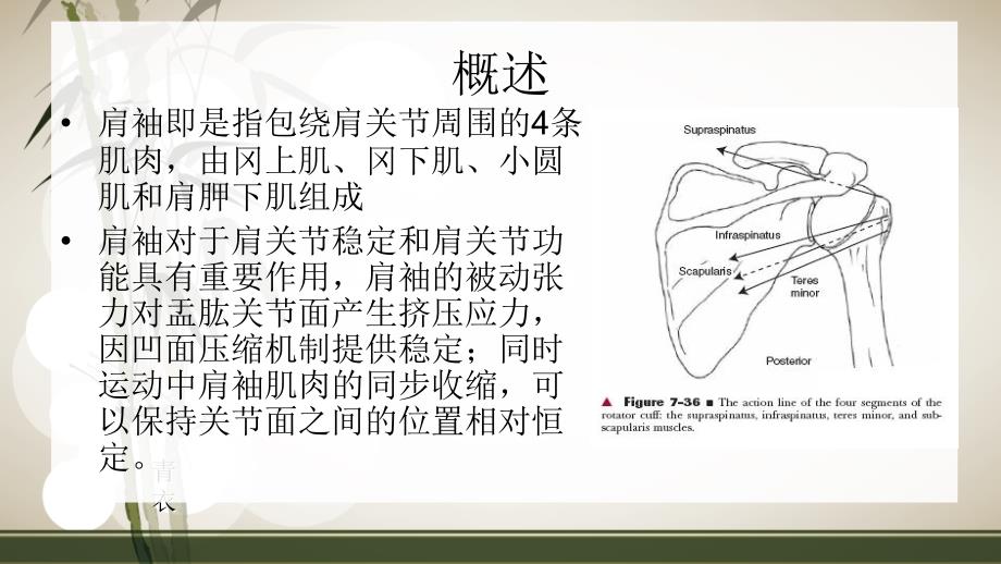 肩袖损伤的康复PPT课件_第3页