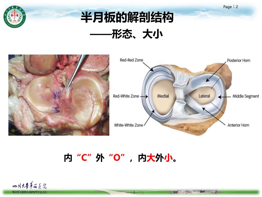 半月板损伤的诊治_第2页