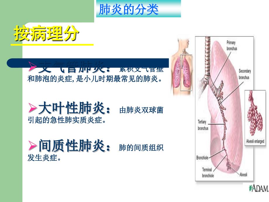 小儿肺炎护理课件.ppt_第4页