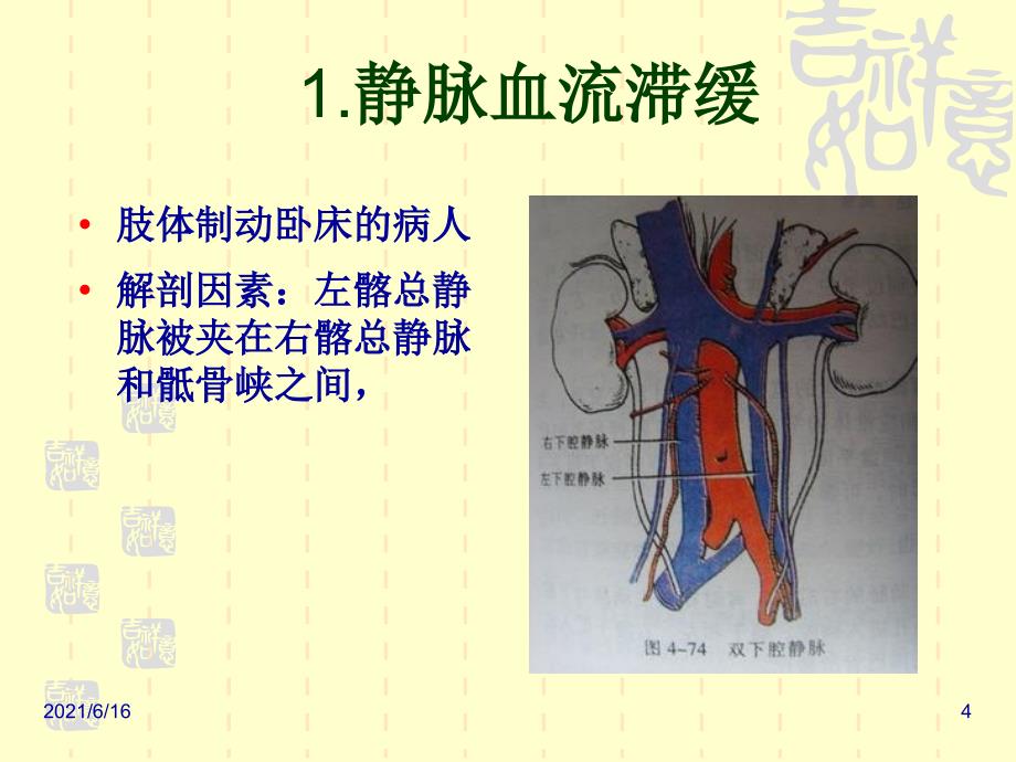 下肢深静脉血栓课件1_第4页