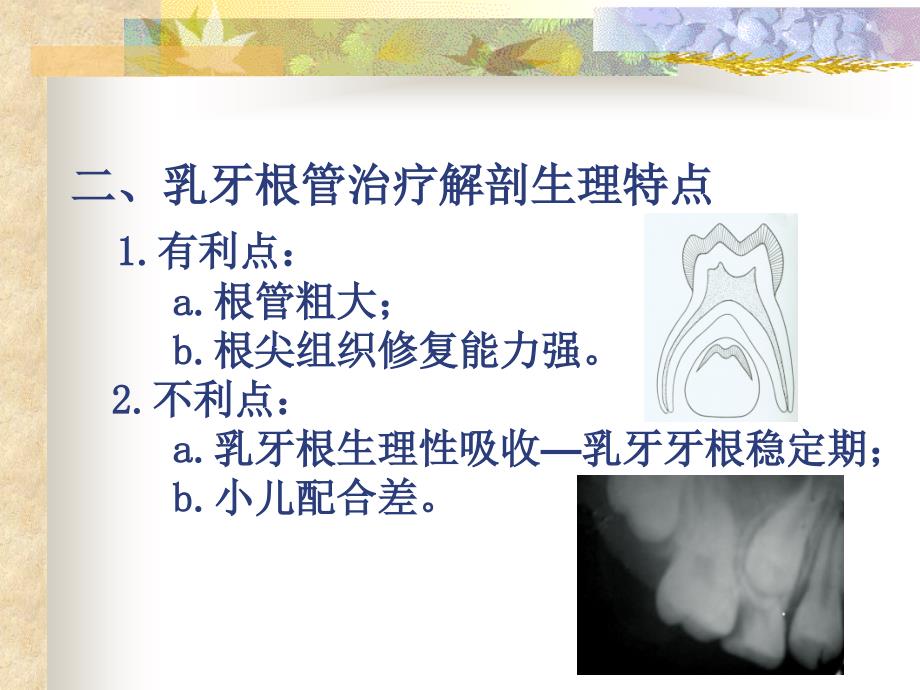 乳牙的根管治疗课件.ppt_第4页