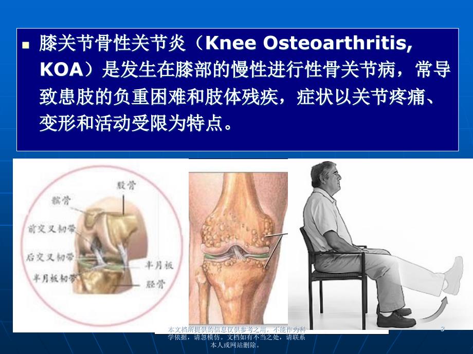 膝关节骨性关节炎的诊断及治疗_第3页