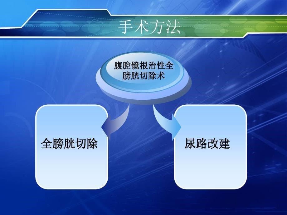 腹腔镜下根治性全膀胱切除术_第5页