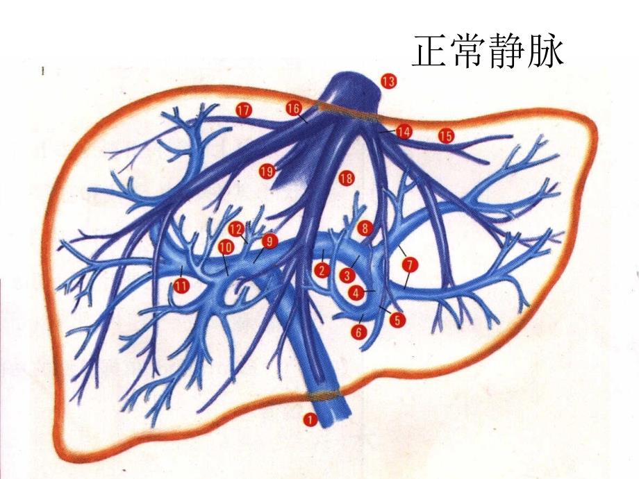 肝胆影像学诊断课件文档资料_第4页