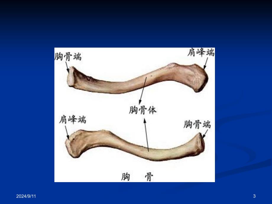 上肢骨关节损伤pt课件_第3页