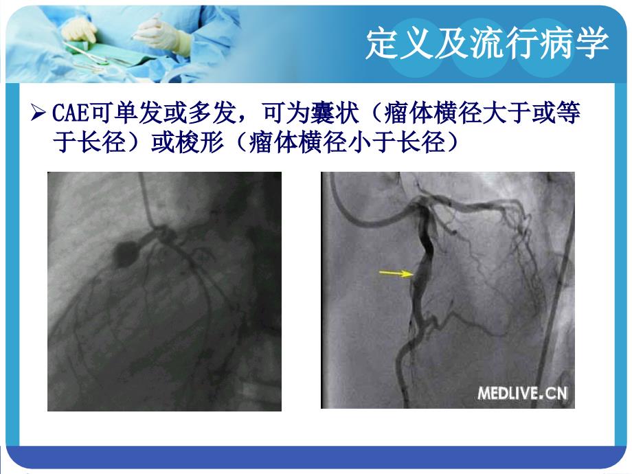 冠状动脉扩张ppt课件_第4页