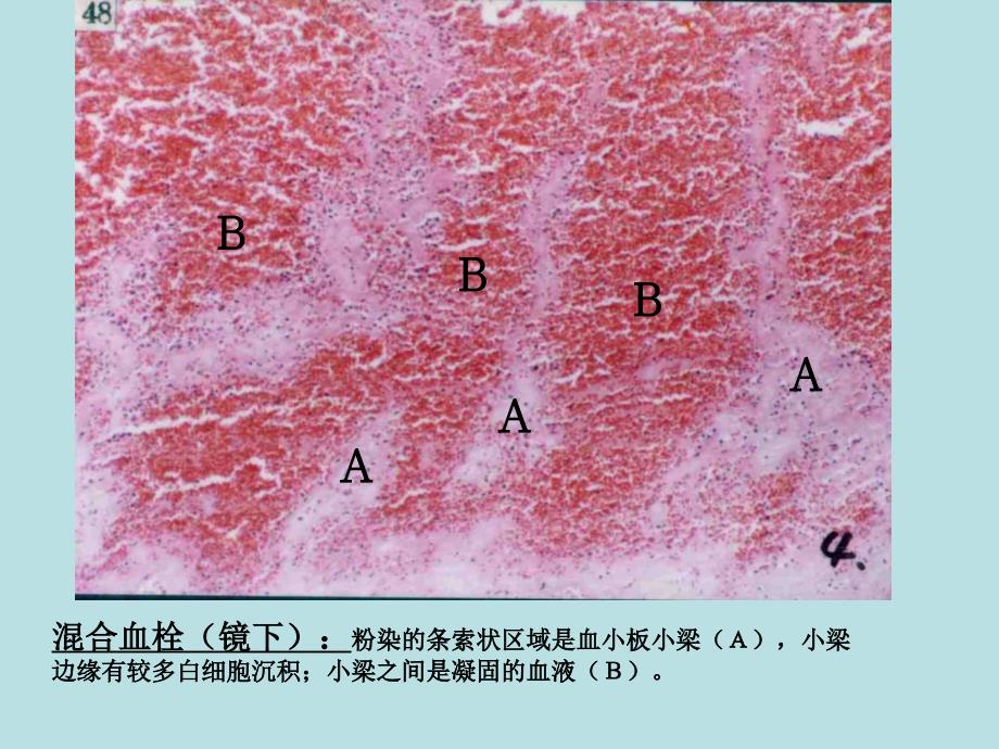 病理实验图片仅供参考_第2页