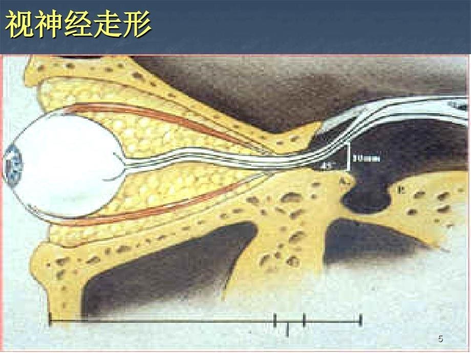 视神经及视路疾病优秀课件_第5页