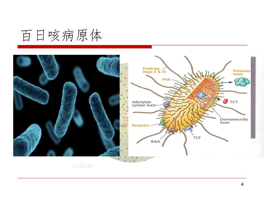 百日咳综合征(课堂PPT)_第4页