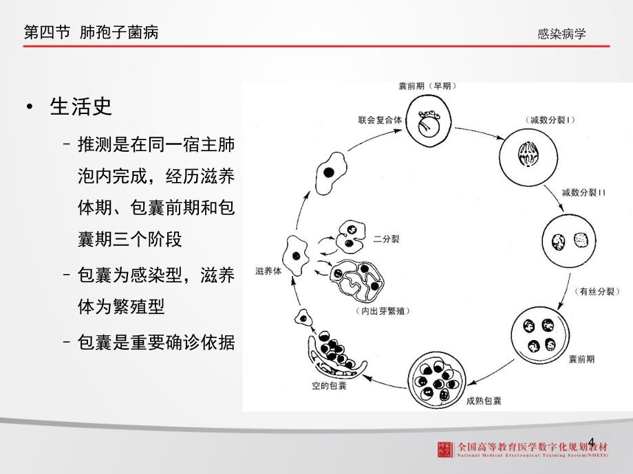 肺孢子菌病课堂PPT_第4页