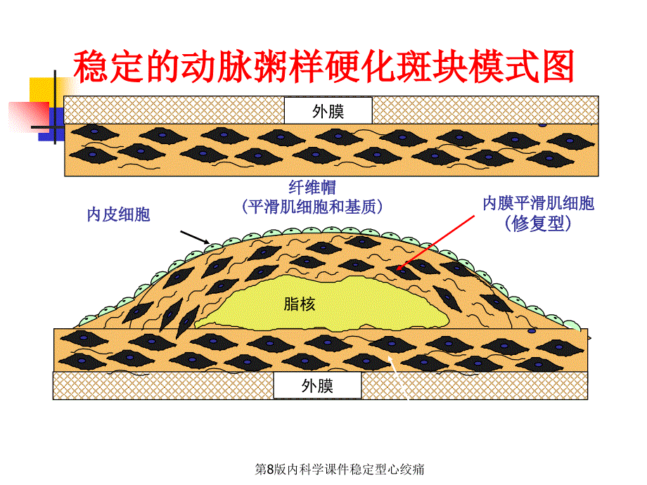 第8版内科学课件稳定型心绞痛经典实用_第4页