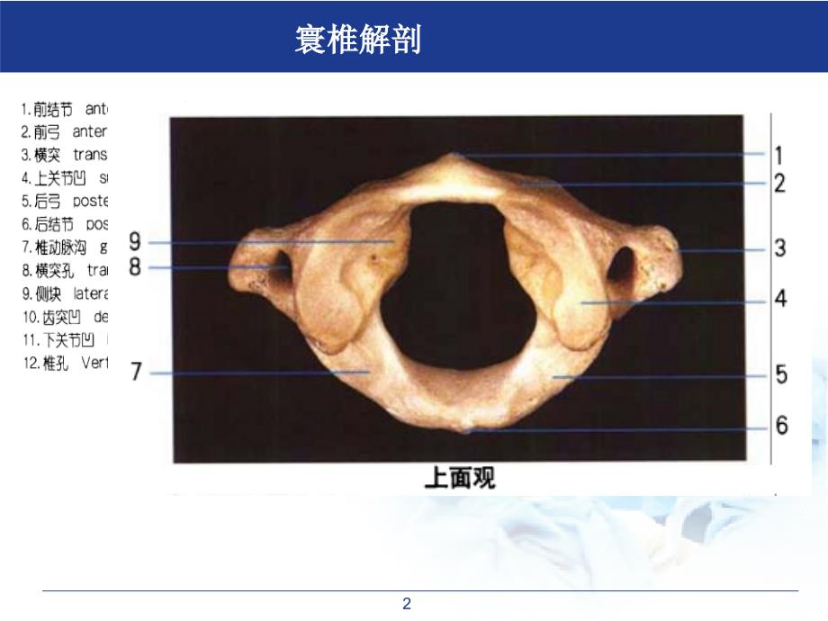 医学课件寰枢关节半脱位_第2页