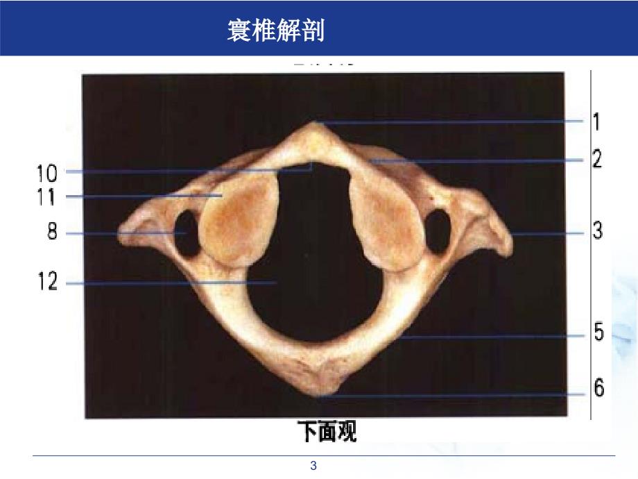 医学课件寰枢关节半脱位_第3页