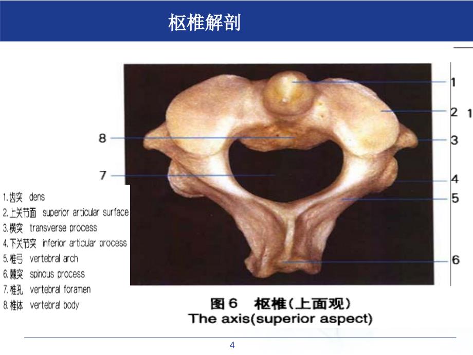 医学课件寰枢关节半脱位_第4页