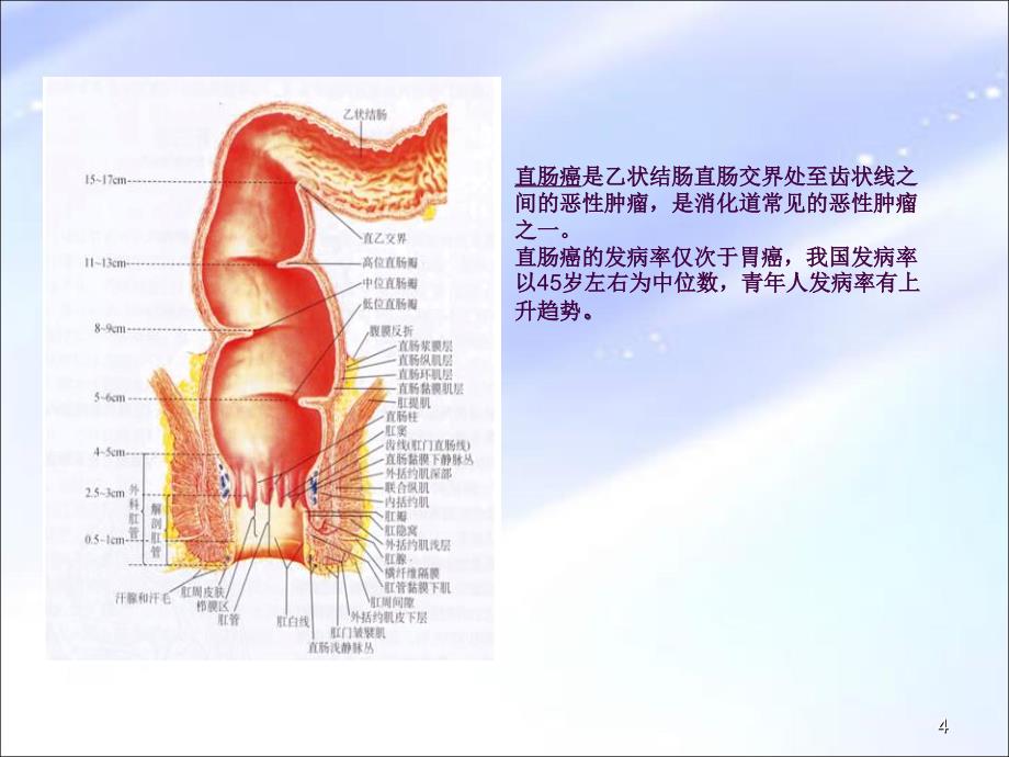 直肠癌术后护理查房2ppt课件_第4页