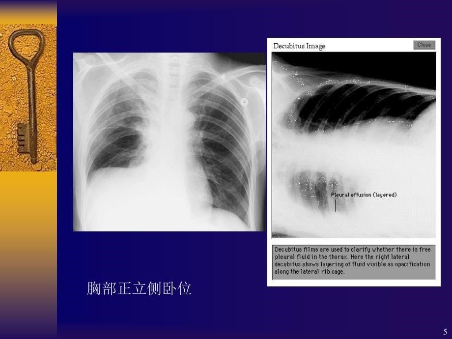 胸部正常浦炫_第5页