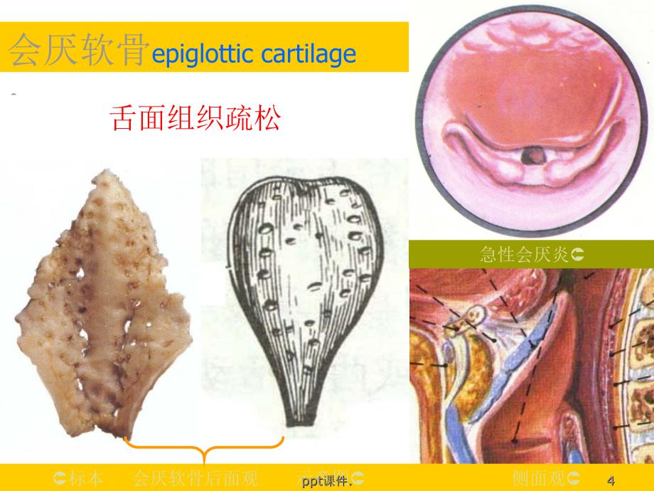 喉解剖喉阻塞精选幻灯片_第4页