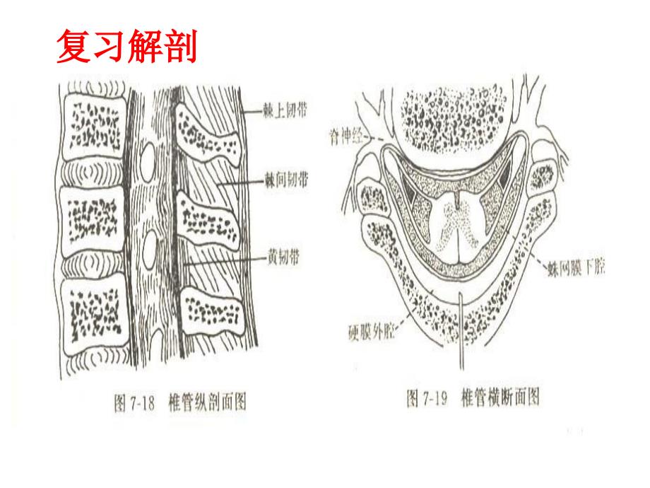 椎管麻醉护理_第4页