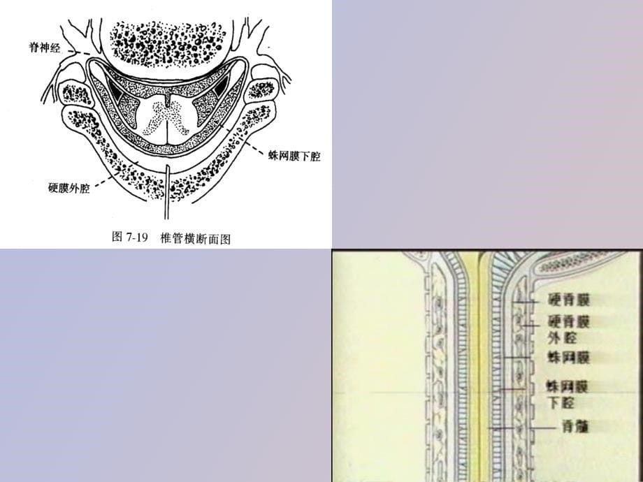 椎管麻醉护理_第5页