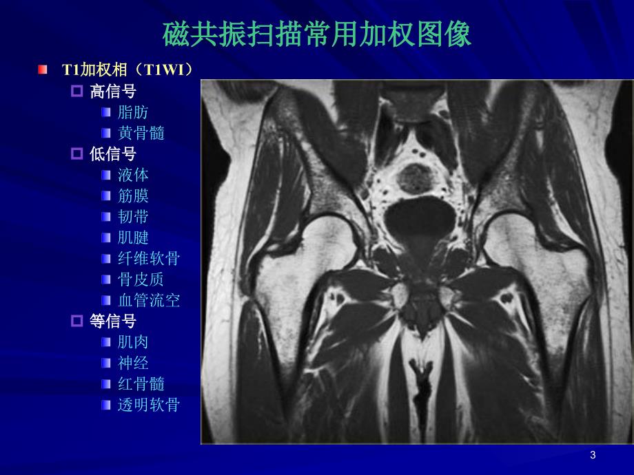 医学课件骨肌磁共振诊断基础_第3页