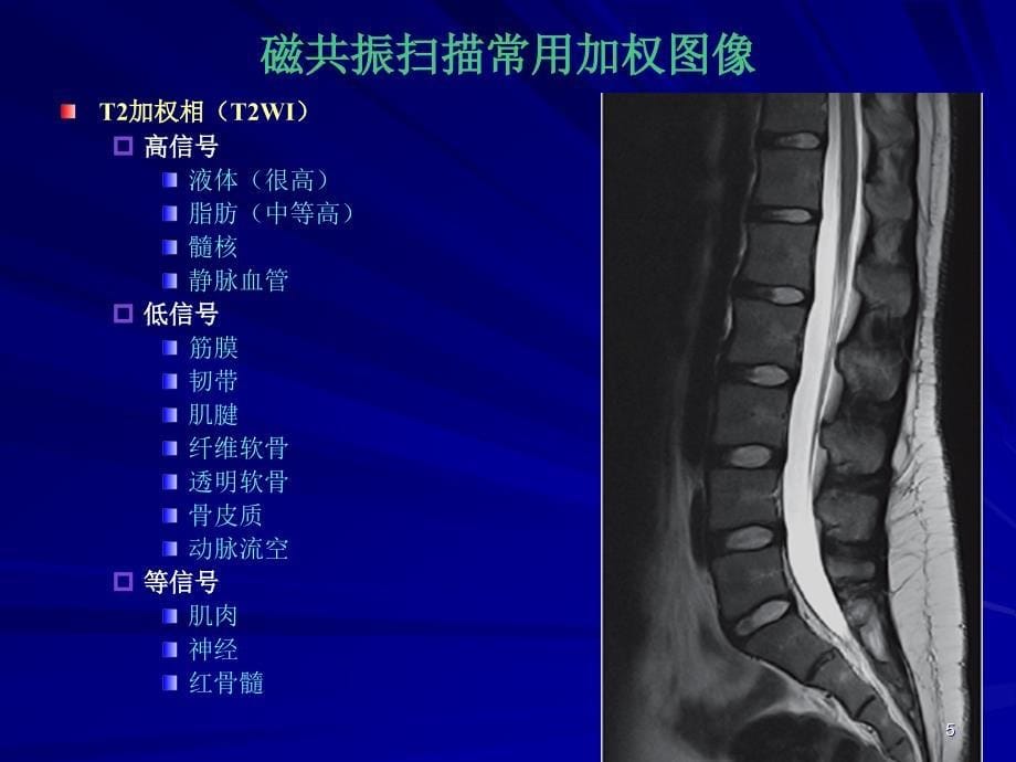 医学课件骨肌磁共振诊断基础_第5页