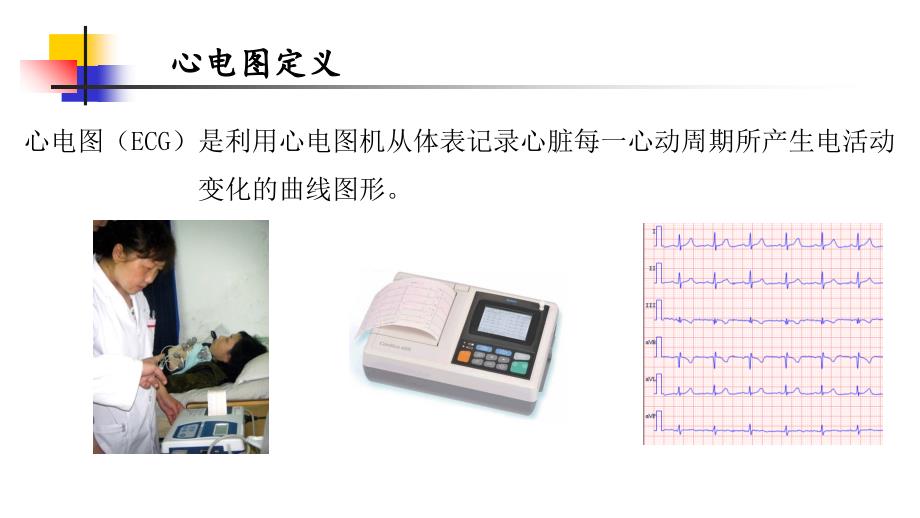 《心电图入门培训》PPT课件_第4页